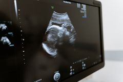 Chile rejeita projeto de descriminalização do aborto até as 14 semanas