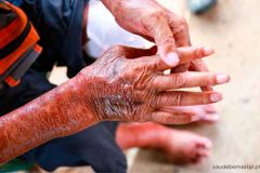 Mulher é curada milagrosamente de doença terminal e conta testemunho