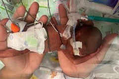 Com 1% de chance de vida, bebê que nasceu com 21 semanas sobrevive após oração da mãe