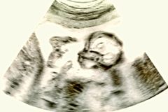 Convenção Batista do Sul pede “abolição imediata do aborto sem exceção”