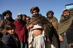 Afegãos são forçados a vender rins para alimentar seus filhos