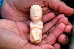 Mais de 62 milhões de abortos foram realizados nos EUA, desde sua legalização