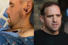 Motorista do Uber sobrevive a tiro na cabeça durante assalto: ‘Orei a Deus’