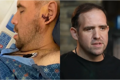 Milagre? Motorista toma tiro na cabeça, faz oração e é salvo consciente