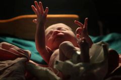 Pesquisa: 79% dos brasileiros são contra a legalização do aborto no Brasil