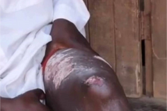 Diretor de escola islâmica é queimado vivo, após ser visto orando a Jesus