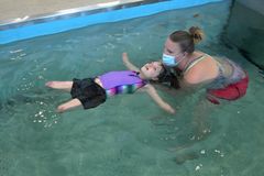 Menina perde braços e pernas após acidente e vira exemplo de fé