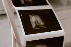 MP pede uso de anestesia em bebês abortados com cloreto de potássio