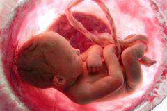 Cerca de 42 milhões de bebês foram abortados em todo o mundo, no ano de 2018