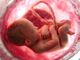 Cerca de 42 milhões de bebês foram abortados em todo o mundo, no ano de 2018