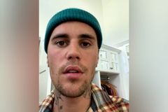 Justin Bieber pede orações ao revelar paralisia facial: "Eu confio em Deus"