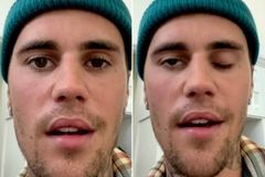 Justin Bieber pede oração após ter paralisia facial: “Confio em Deus”