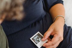 Luta contra o aborto: um tema que não pode ser esquecido em ano eleitoral