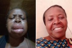 Tubérculo venenoso quase mata mulher, que foi curada após oração