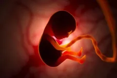 Kansas mantém "direito" ao aborto contrariando decisão da Suprema Corte
