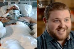 Jovem que teve 40% do corpo queimado em acidente sobrevive milagrosamente após orações