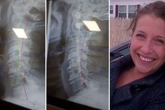 Mulher testemunha cura ao declarar a palavra de Deus sobre sua coluna