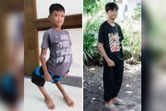 Menino que nasceu com as pernas viradas agora pode andar: "Deus faz milagre"