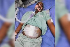 Pastor na Índia é esfaqueado em emboscada após pregar para sikh