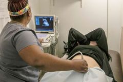 ‘Abortômetro': 39 milhões de bebês mortos no ventre em 2022