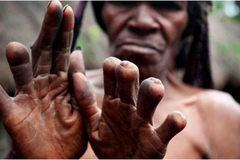 Missionário supera o risco de morte para evangelizar canibais