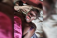 Pastor é atacado com ácido por muçulmano e perde parte da visão, em Uganda