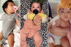 "Deus faz milagres": Bebê com ferimentos é curada através do clamor da igreja