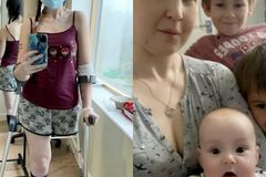 Diagnosticada com câncer pela terceira vez, mãe decide amputar perna para não abortar bebê