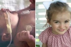 Pais se rendem a Jesus após bebê ser curada de lesão cerebral: \"Ele ouviu as orações\"