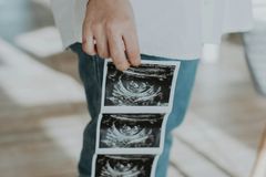 Escócia registra recorde histórico em números de abortos