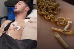 Jovem sobrevive a tiro após bala atingir colar de cruz: \"Deus é a razão de eu estar vivo\"