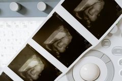 Irlanda registra quase 11 mil abortos e estabelece novo recorde em 2024