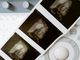 Irlanda registra quase 11 mil abortos e estabelece novo recorde em 2024