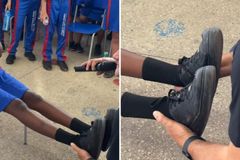 Menina com uma perna maior que a outra é curada após oração de pastor em escola
