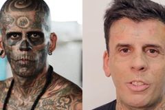 Homem mais tatuado do Brasil que se converteu remove tatuagens do rosto: \"É sobre Jesus\"