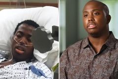 Homem é curado de anemia genética após orações: \"Deus fez algo tremendo\"