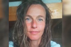 Mulher com bactéria comedora de cérebro sobrevive após ver Jesus: ‘Seu toque me curou’