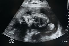 Contra aborto, Porto Rico passa a reconhecer feto como \"pessoa natural\" desde a concepção