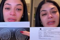 Rayssa Buq diz que cisto no cérebro sumiu após campanha de oração: “Jesus me curou”