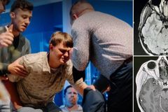 Tumor no cérebro de jovem de 17 anos desaparece após oração: “Jesus ainda cura”