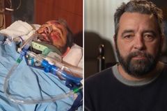 Homem que passou por 25 cirurgias após ser atropelado testemunha: “Sou um milagre”