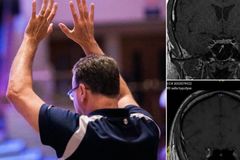 Tumor cerebral em homem desaparece após orações: “Os médicos não entenderam”