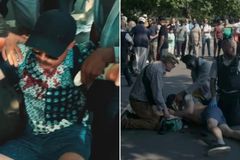 Pregador de rua fica ensanguentado após ser agredido em parque de Londres