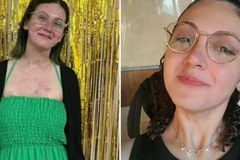 Jovem supera síndrome rara e se torna missionária na Ásia: “Deus cumpriu a promessa”