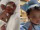 Bebê prematuro recebe alta após nascer com apenas 24 semanas: “Um milagre”