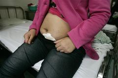 China Amends One-Child Policy to Forced Abortion of Third Baby