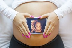 Court Rules Texas Heartbeat Law Can Remain in Place While Litigation Continues