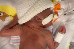 Baby Had Virtually No Chance of Survival — Then the Record-Breaking Preemie Shocked Doctors and 'Defied All Scientific Odds'