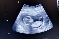 Bishop Barron: True dialogue impossible if Catholic Dems won’t protect babies who survive abortion