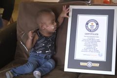 Infant born at 21 weeks breaks Guinness world record for most premature baby to survive